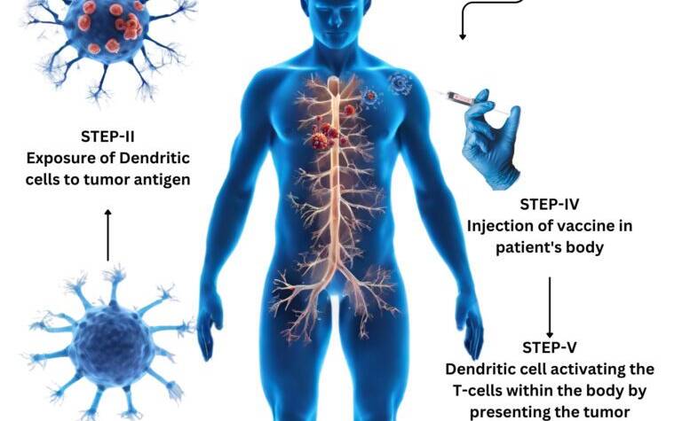 dendritic cell therapy