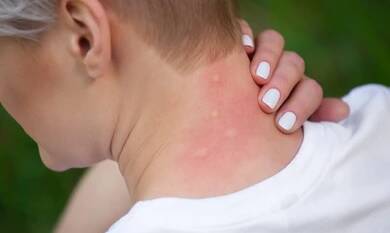 Fenbendazole 1000mg: A Powerful Antiparasitic Treatment