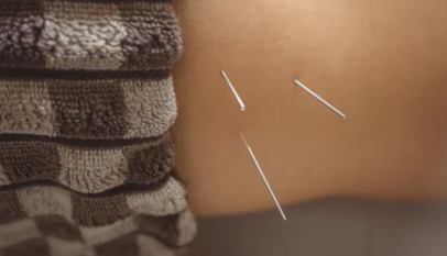 Traditional Chinese Medicine