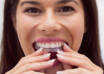 clear aligners dubai